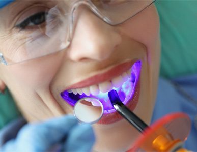 A young woman receiving a dental sealant