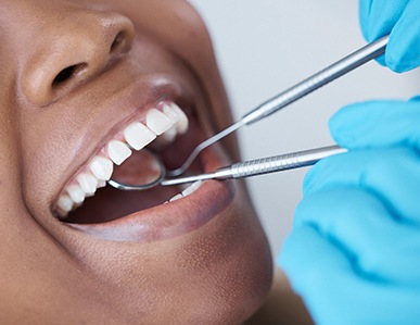 Patient having teeth examined during dental checkup in Superior, WI