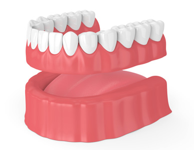 Illustration of denture