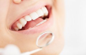 A closeup of a person’s smile during a dental exam.