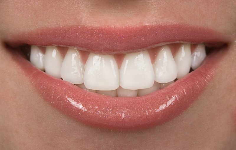 Person’s smile after receiving teeth whitening