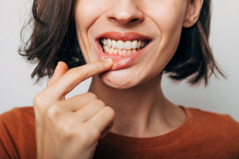 Lady shows off gums